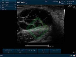 Портативный аппарат УЗИ Edan U50 (для педиатрии и кардиологии, стандартный)