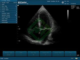 Портативный аппарат УЗИ Edan U50 (для педиатрии и кардиологии, стандартный)