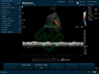 Стационарный аппарат УЗИ Edan U2 (для педиатрии и кардиологии, стандартный)