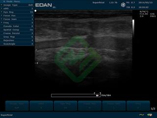 Стационарный аппарат УЗИ Edan U2 (для кардиологии, стандартный)